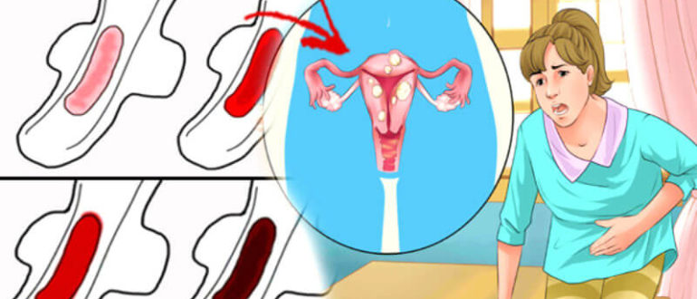 Месячные не такие как всегда