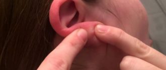 Вавки на мочке уха