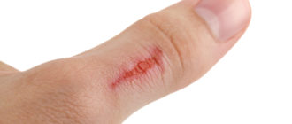 Можно ли пить/курить после наложения швов на порезанный палец?