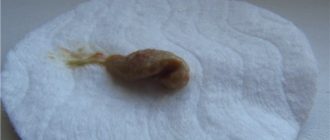 Выделения на 6 неделе