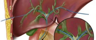 Дренаж из протоки