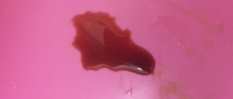 Красная моча после первого полового акта