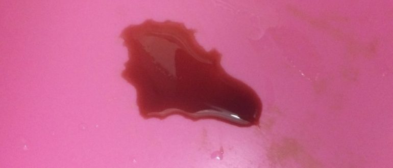 Красная моча после первого полового акта