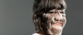 Волосы по всему телу