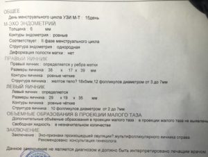 Возможно ли забеременеть при таких показателях узи