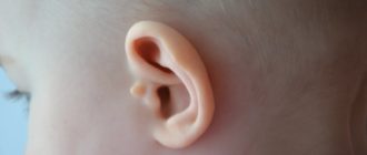 Козелок ушка у ребенка
