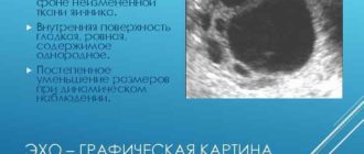 Мелкокистозная структура правого яичника