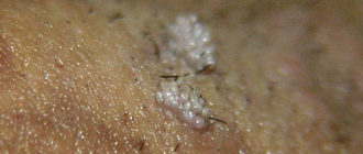 Две маленькие дырочки на половом члене