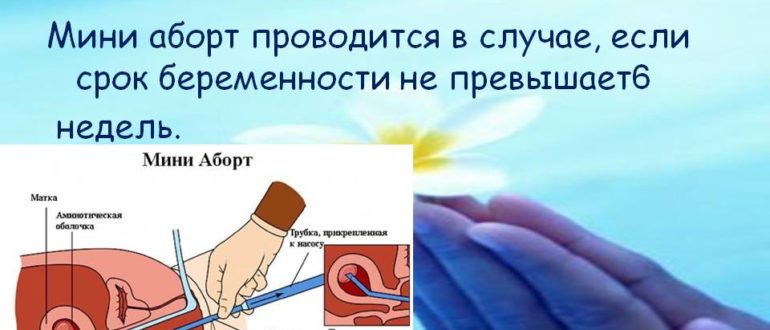 Мини аборт