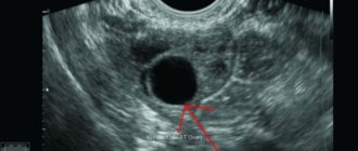 УЗИ после овуляции