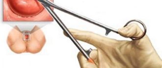 Можно ли делать биопсию нерожавшим