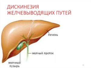 Дискинезия желчевыводящих путей