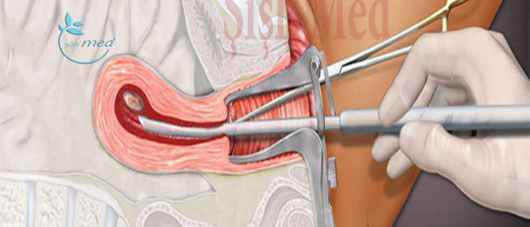 Выделения после рдв
