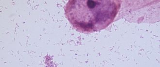 Мобилункус