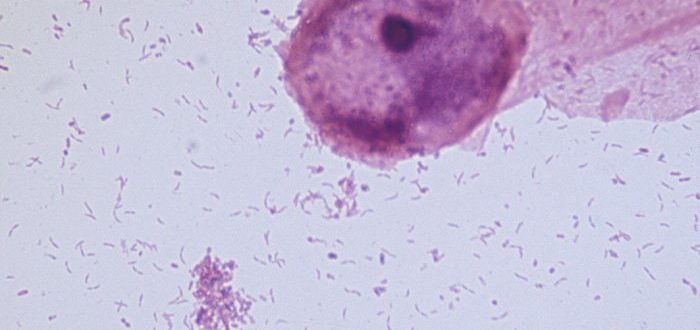 Мобилункус