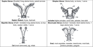 Duplex uteri