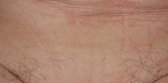 Волосики на лобке дочери 5 месяцев