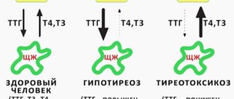 Набор веса при низком ТТГ