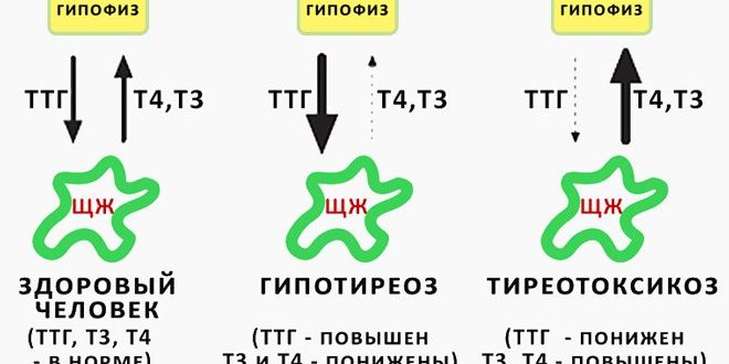 Набор веса при низком ТТГ