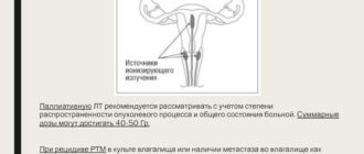 Что означает лт-эм с маточными трубами