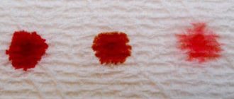 Месячные, алая кровь