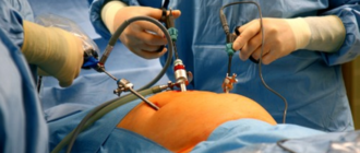 Можно ли избежать операции?