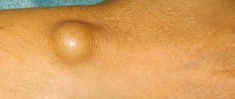 Что за шишки могут быть?