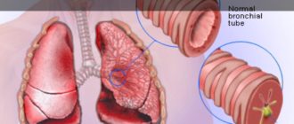 Вибрация при кашле