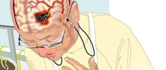 Думали инсульт, оказалось - опухоль головного мозга. Что делать?