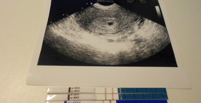 УЗИ через неделю после зачатия