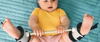 Дисплазия, шина Виленского