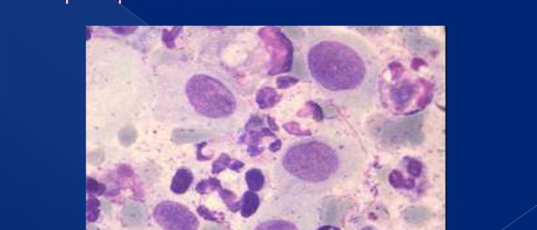 Воспаление с реактивными изменениями эпителия