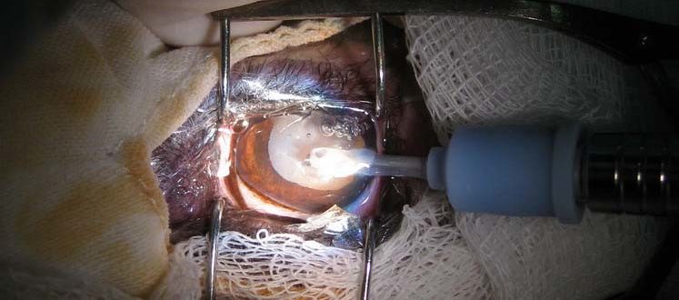 Выделения после выскабливания