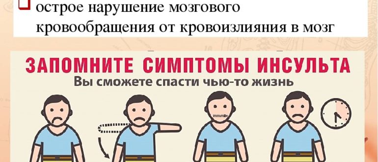 Возможно ли в 15 лет получить инсульт