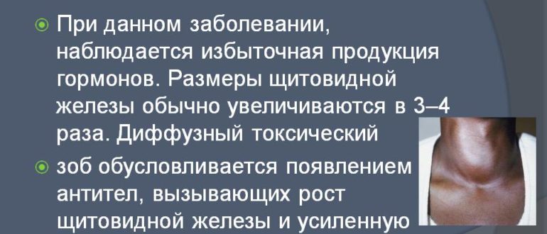 ДИффузно токсический зоб. Беременность при данном заболевании