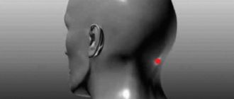 Косточки на затылке