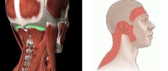 Напряженность мышц шеи