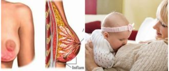 Можно ли простудить грудь?