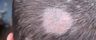 Микроспория