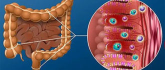 Дисбактериоз, кандидоз