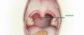 Давит в области горла