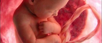 Диагноз- умеренное многоводие, срок 36 недель, стоит ли ложится в стационар