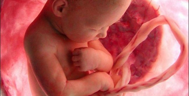 Диагноз- умеренное многоводие, срок 36 недель, стоит ли ложится в стационар