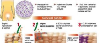 ВПЧ лечить или нет?