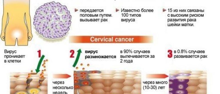 ВПЧ лечить или нет?