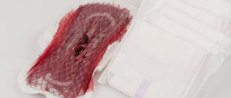 Месячные после кровотечения