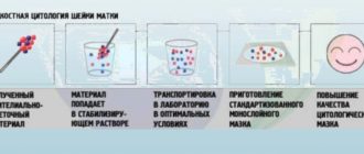 Может ли жидкостная онкоцитология не показать дисплазию или рак?