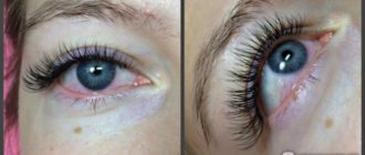 Нарастила ресницы а белок красный уже второй день что делать?