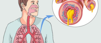 Что-то попало в легкие