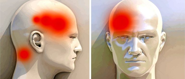 Мутная голова, головные боли